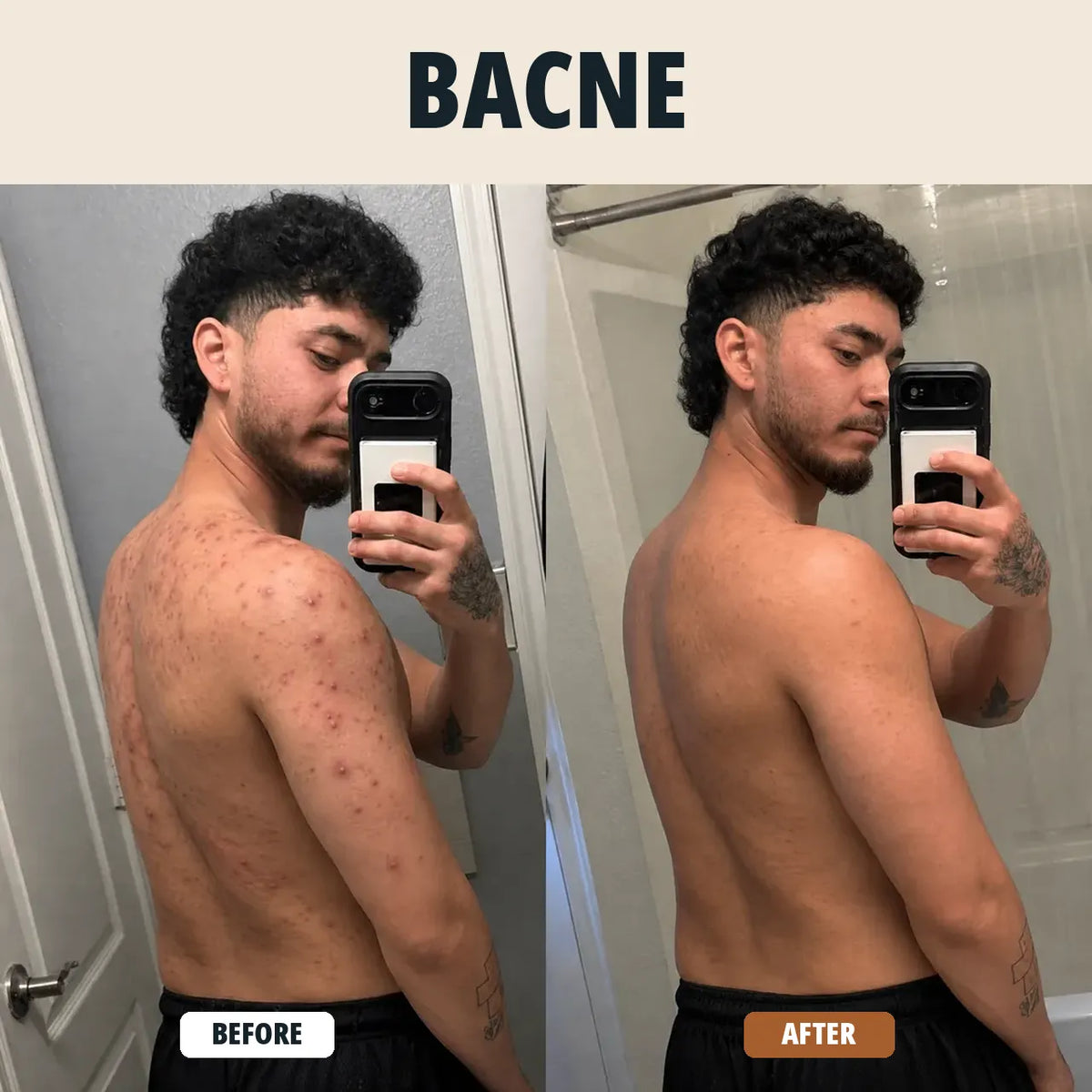 BODY ACNE WASH