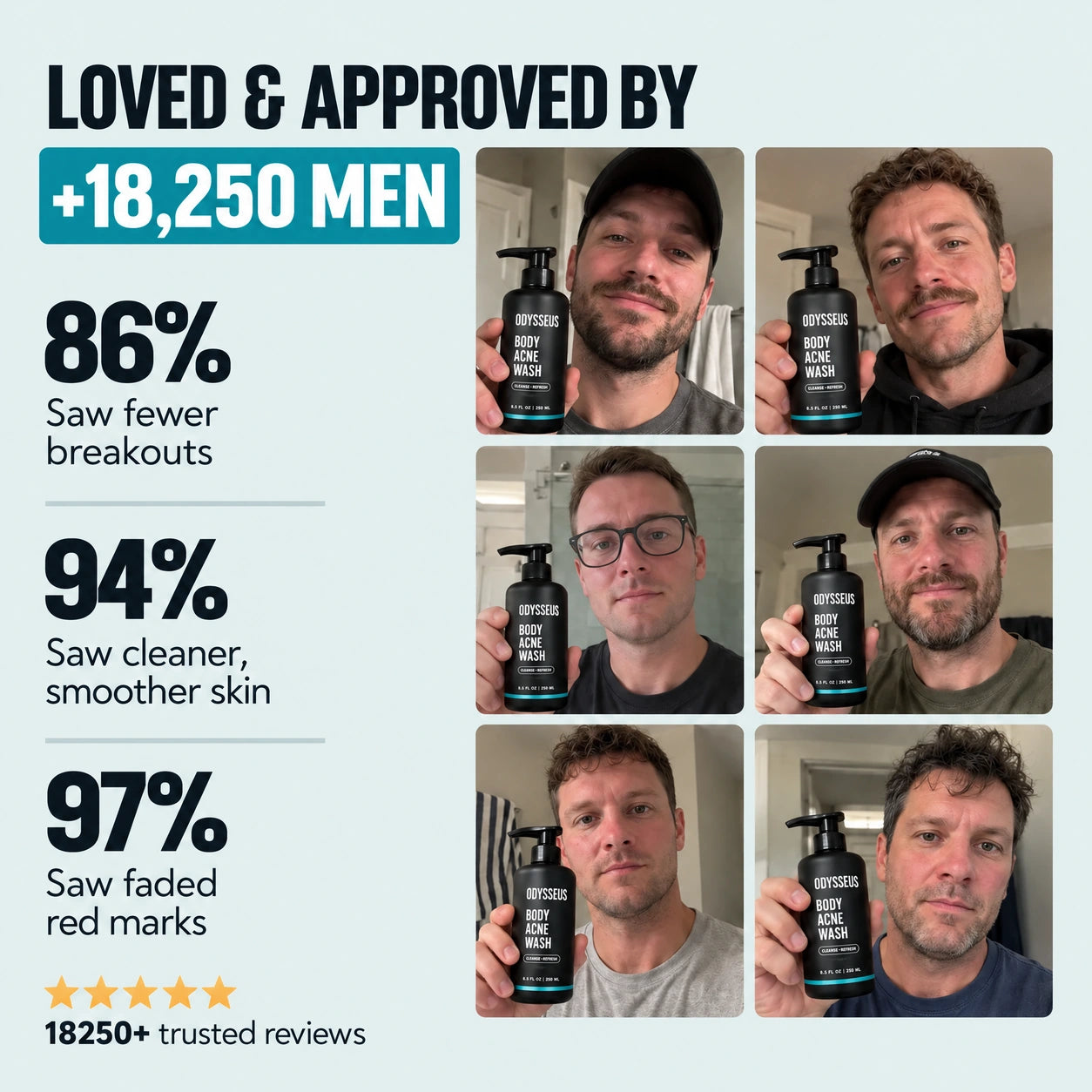 ODYSSEUS BODY ACNE WASH