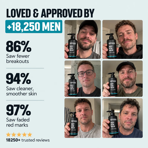 ODYSSEUS BODY ACNE WASH
